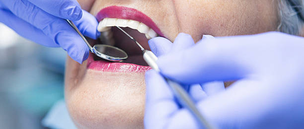 Best Chipped Tooth Repair Near Me  in Galveston, TX